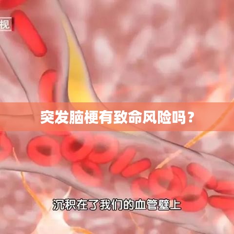 突發(fā)腦梗有致命風(fēng)險嗎？
