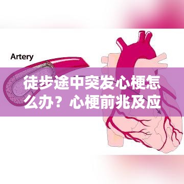 徒步途中突發(fā)心梗怎么辦？心梗前兆及應(yīng)對(duì)措施科普！
