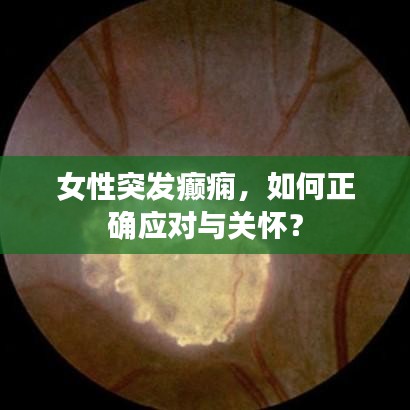 女性突發(fā)癲癇，如何正確應對與關懷？