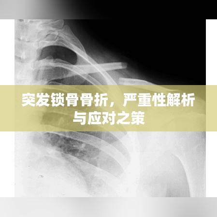 突發(fā)鎖骨骨折，嚴(yán)重性解析與應(yīng)對之策