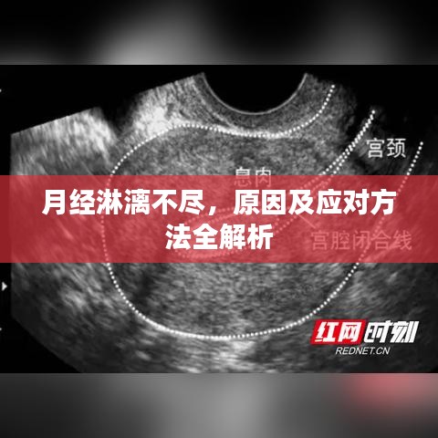月經(jīng)淋漓不盡，原因及應(yīng)對方法全解析