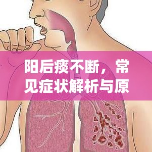 陽(yáng)后痰不斷，常見癥狀解析與原因探究