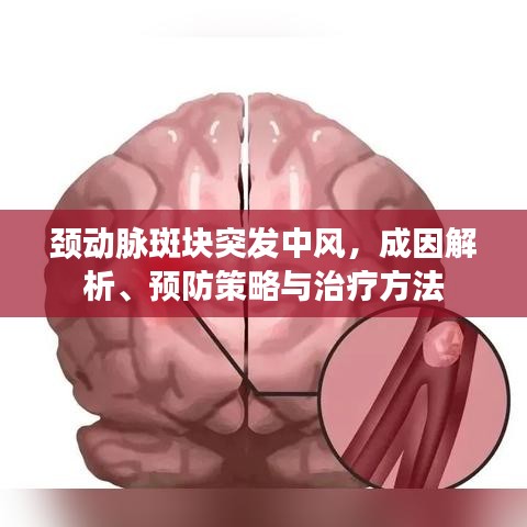 頸動(dòng)脈斑塊突發(fā)中風(fēng)，成因解析、預(yù)防策略與治療方法